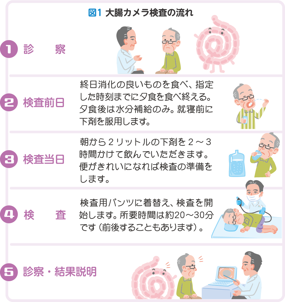 図1 大腸カメラ検査の流れ