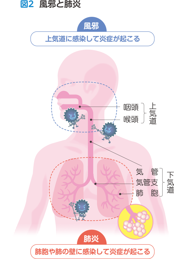 図2  風邪と肺炎